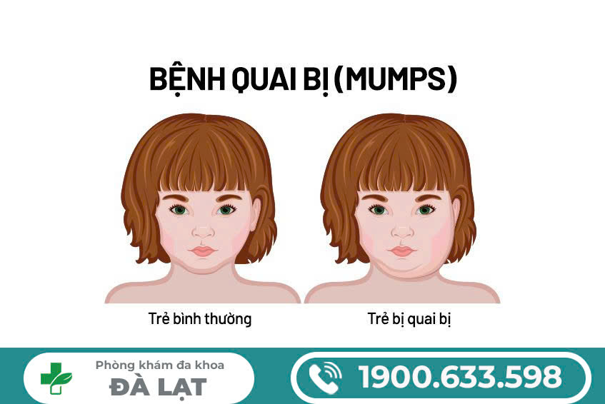 Hình ảnh minh họa